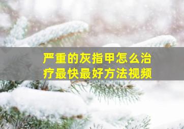 严重的灰指甲怎么治疗最快最好方法视频