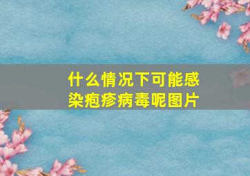 什么情况下可能感染疱疹病毒呢图片