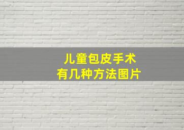 儿童包皮手术有几种方法图片