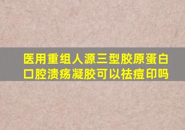 医用重组人源三型胶原蛋白口腔溃疡凝胶可以祛痘印吗