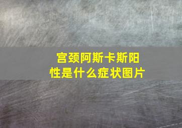 宫颈阿斯卡斯阳性是什么症状图片