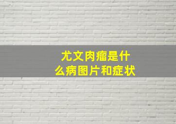 尤文肉瘤是什么病图片和症状