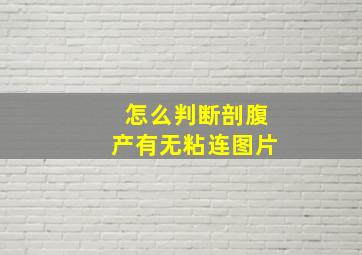 怎么判断剖腹产有无粘连图片