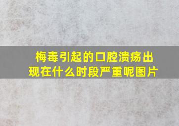 梅毒引起的口腔溃疡出现在什么时段严重呢图片