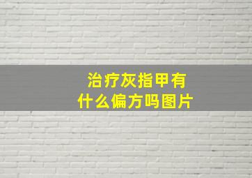 治疗灰指甲有什么偏方吗图片