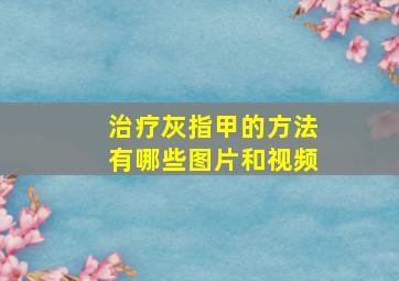 治疗灰指甲的方法有哪些图片和视频