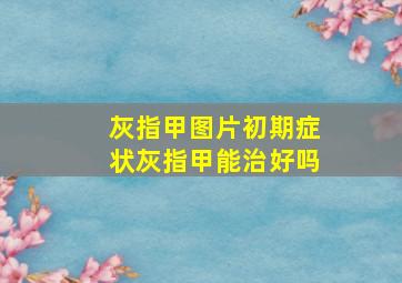 灰指甲图片初期症状灰指甲能治好吗