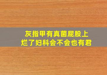 灰指甲有真菌屁股上烂了妇科会不会也有君