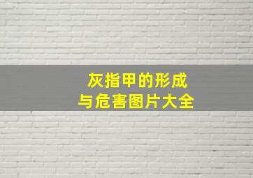 灰指甲的形成与危害图片大全