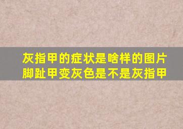 灰指甲的症状是啥样的图片脚趾甲变灰色是不是灰指甲