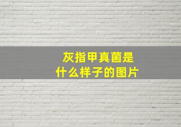 灰指甲真菌是什么样子的图片