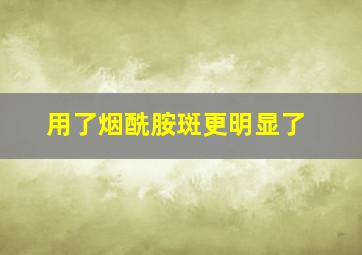 用了烟酰胺斑更明显了