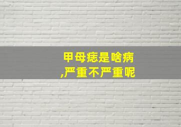 甲母痣是啥病,严重不严重呢