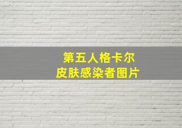 第五人格卡尔皮肤感染者图片