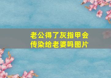 老公得了灰指甲会传染给老婆吗图片