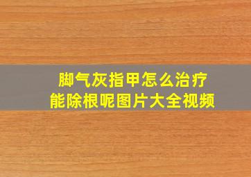 脚气灰指甲怎么治疗能除根呢图片大全视频